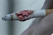 Tumours On A Cigarette