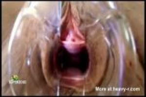 Inside Of A Vagina