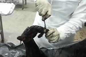 Necropapiloscopy Of Burned Victim