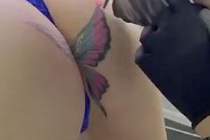 Ass Tattoo Removal